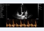 Mobile Ultrasound Scanner Phased Array Probe Wireless Portable 3.6mhz 7.5/10mhz