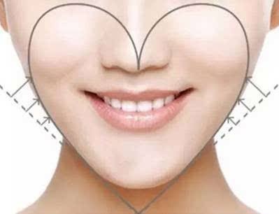 Female Care Hyaluronic Acid Facial Filler For Chin Augmentation Long Lasting