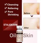 Organic Herbal Serum Anti Acne Customized Label Dermapen Face Essence For Oily