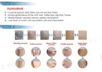 8% Filter System ND YAG Tattoo Laser Removal Machine 2 Million Times Xenon Lamp
