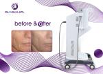 0.1-2.5J Hifu Face Lifting Machine / Hifu Facial Treatment Wrinkle Remover