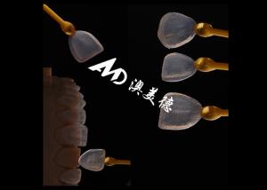 Wholesale Strength EMAX Veneer Natural Appearance Excellent Fit for Esthetic Restorations from china suppliers