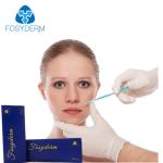 Natural Looking 1ml Dermal Lip Fillers Injection For Lip Enhancement Safety