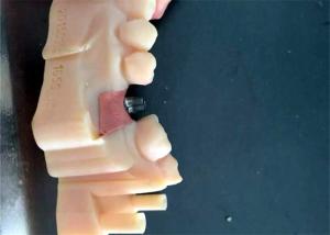 Wholesale CAD / CAM PFM Dental Crowns Bridge Resin Material Good Biocompatibility Stability from china suppliers