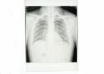 White Medical Paper Chest X Ray Film Waterproof High Sharpness