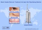 RF Fractional CO2 Laser For Stretch Marks Scar Removal Vaginal Tightening