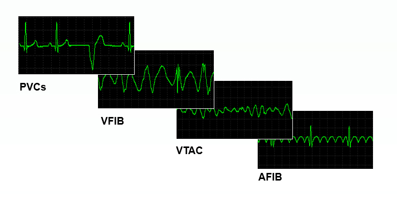 12.1 inch medical wireless multi-parameters vital signs monitor newtech criticare capnography patient monitor for hospit