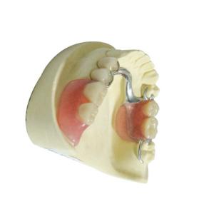 Wholesale Professional Dental Lab Products Acrylic Removable Partial Dentures from china suppliers