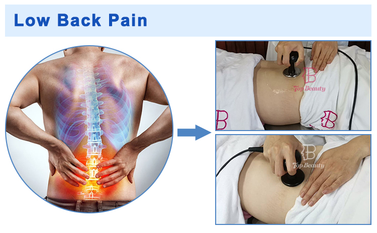 Tecar 9.1 Sports Rehabilitation Physio Tekar Machine Continues Adjustable