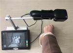 Medical Portable Vein Locator Device Spider Vein Removal Machine Imaging Depth <