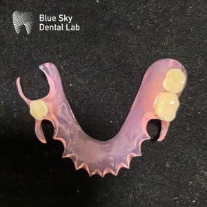 Wholesale Customize Removable Acrylic Partial Denture Natural Looking Valplast Dental Partials from china suppliers