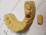 High Precision ISO13485 Trushine Dental 3D Print model