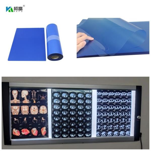 210microns Inkjet Medical X Ray Film For CT DR MRI And 3D CT MRI Image Output