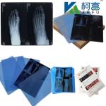 14*17 Inch Medical X-Ray/CT/DR Dry Scan Film For X-Ray Laser Image Printer And