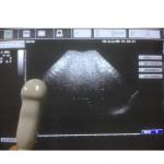 Esaote CA123 Convex Array Ultrasound Scan Probe for MyLab 25 Series