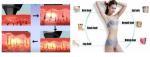 Pain Free 808nm Diode Laser Hair Removal Machine For Body Depilation
