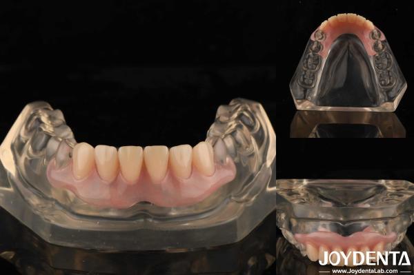 Tooth Arrangement Technology Flexible Denture Finish High Elasticity Customizati