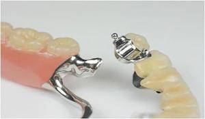 Wholesale Removable Precision Attachment Partial Denture Stable Professional from china suppliers