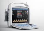 2 Probe Connectors Laptop Ultrasound Scanner Color Doppler Machine With High