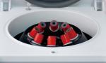 2200×g RCF ABS Fixed Rotor Centrifuge Benchtop Low Speed 15ml Tubes