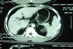 Custom Waterproof Medical Diagnostic Imaging X Ray Film For Thermal Printer