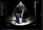 Android WiFi Wireless Ultrasound Probe For Iphone USB Port Hand Scan Ultrasound