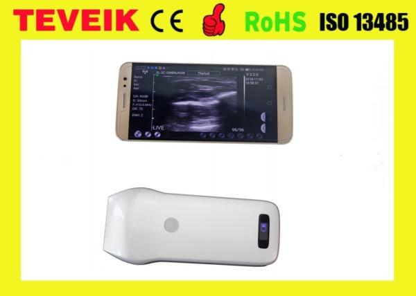 Factory Price Medical Digital 7.5MHz High Frequency Doppler Linear Ultrasound