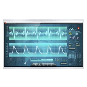 Wholesale 11.6 Inch IPS 1920x1080 Wide Temperature TFT Display Sunlight Readable from china suppliers