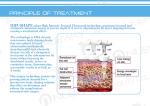 Best Beauty Salon Spa fat loss high-tech hifu slimming machine