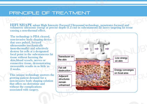 Beijing hifu slimming machine best non-invasive technology worldwide