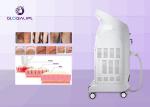 FDA Approved Commercial Laser Hair Removal Machine 808nm Diode Laser For Beauty