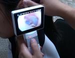 Rechargeable Portable Otoscope Ophthalmoscope Dermatoscope With SD Card Output