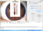 Green Iris Recognition Camera Iridology Device English Spanish Chinese