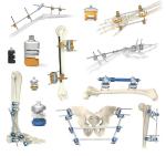 Lateral Limb Reconstruction External Fixator Single Sided