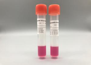 Wholesale Virus Sampling Tube Kit 1.6*10 CM Consumable Medical Supplies from china suppliers