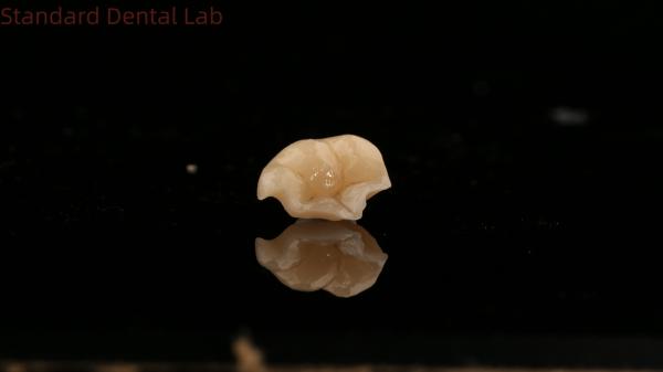 Strength Emax Ceramic Crown Dental Onlay with Excellent Stain Resistance China