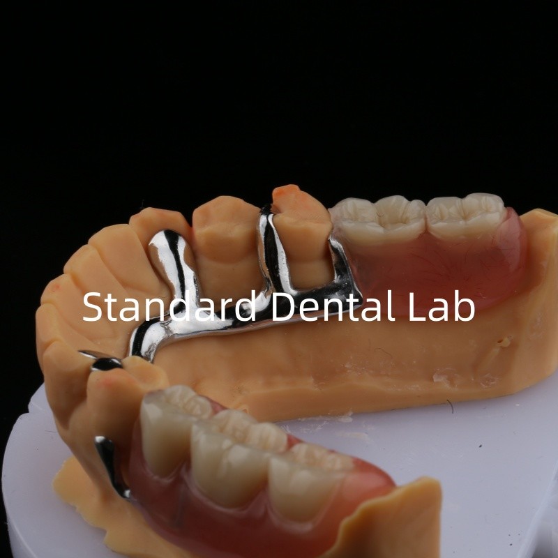 Alloy Metal Partial Denture Framework 3 Shape Exocad Laser Printing Lower Cast Partial Finish