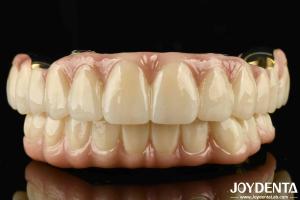 Wholesale Excellent Strength Ti-Bar Zirconia Hybrid Bridge For Natural Teeth And Gums Compatibility from china suppliers