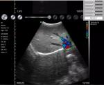 Ultrasound Machine Wireless Ultrasound Probe 192 Elements Wifi Handheld Color