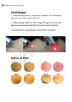 Professional manufacturer 980 nm laser diode machine for skin tags / vascular