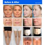 Multifunction Body Slimming RF Device Infrared Laser Vacuum RF Beauty Machine