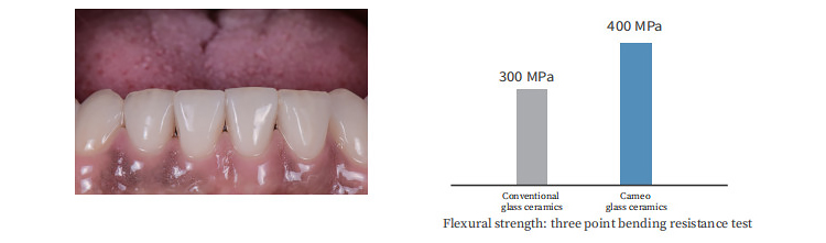360Mpa ~ 400Mpa Class II Dental Lithium Disilicate Zirconia Glass Ceramic