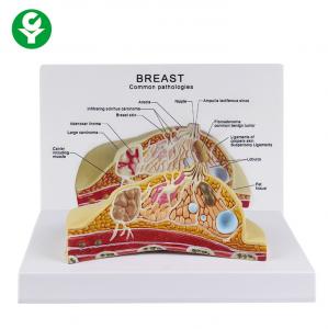 Wholesale Female Cross Section Breast Cancer Model Anatomical 1.0 Kg Single Gross Weight from china suppliers