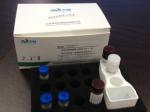Tumor Marker Calibrator Kits CLIA In Vitro Diagnostics Chemiluminescence