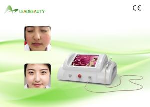 Wholesale CE Approval 30MHZ high frequency rbs vascular spider vein removal machine from china suppliers