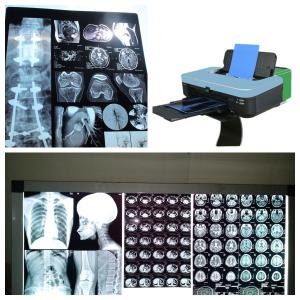 Wholesale Glossy Inkjet X Ray Film With Low Fog Color Image For Inkjet Printing from china suppliers
