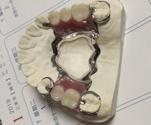 Wholesale Maxillary Arch Co Cr Alloy Partial Denture Metal Framework from china suppliers
