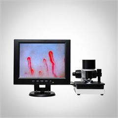 Wholesale LCD Display Health Analyzer Machine Clinical Blood Analysis Microcirculation Microscope from china suppliers