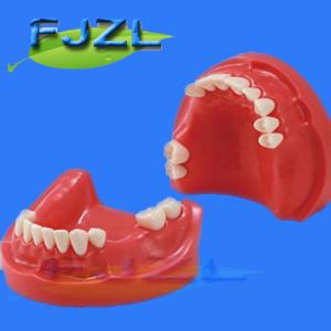 Wholesale dental model for partial denture restorative from china suppliers