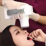 Diameter 45mm Digital Dental X Ray Machine Multiscene Handheld Portable